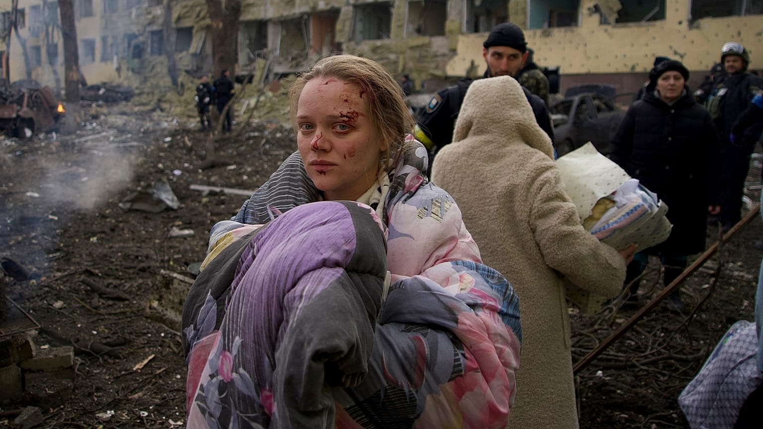 Marianna Vishegirskaya stands outside a maternity hospital that was damaged by shelling in Mariupol, Ukraine, Wednesday, March 9, 2022.