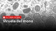 Esta imagen del microscopio electrónico de 2003, facilitada por los Centros para el Control y la Prevención de Enfermedades muestra viruela del mono