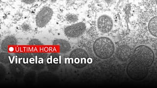 Esta imagen del microscopio electrónico de 2003, facilitada por los Centros para el Control y la Prevención de Enfermedades muestra viruela del mono