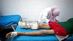 Settembre 2011, un combattente ferito in un ospedale di Misurata, Libia