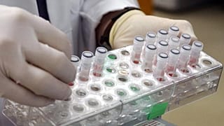 EU will purchase 110,000 doses of monkeypox vaccines to distribute among member states