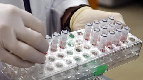 EU will purchase 110,000 doses of monkeypox vaccines to distribute among member states