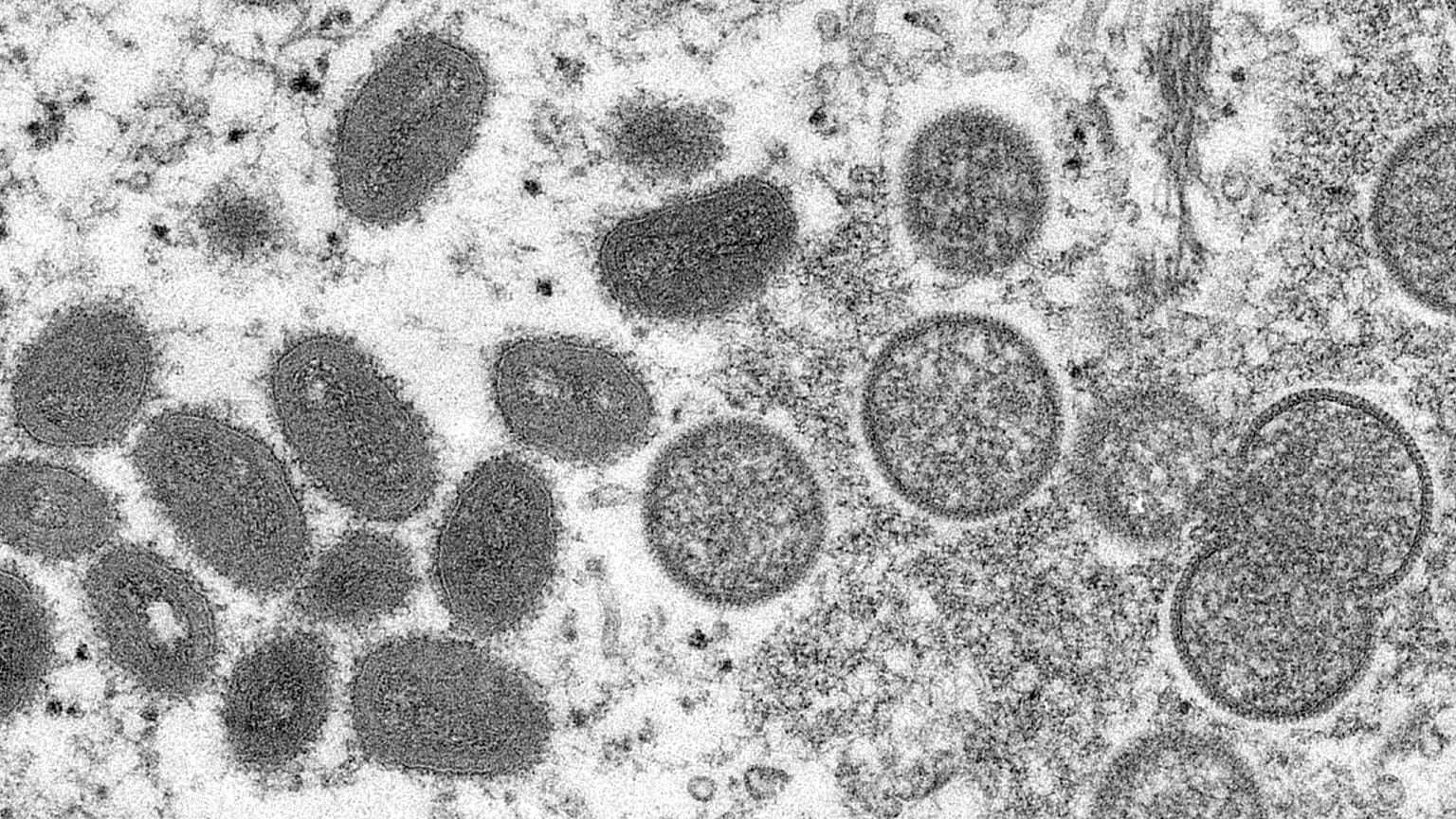 La OMS estudia a fondo la gravedad de la viruela del mono