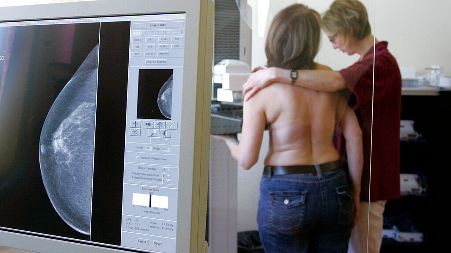 Mammográfiát végeznek egy nőnél 2007 áprilisában