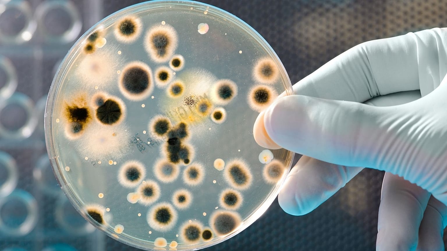A bacterial culture