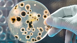A bacterial culture
