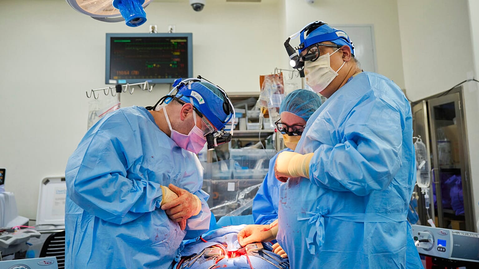 Medicos de NYU Langone Health trabajan con un corazón de cerdo modificado genéticamente en una persona fallecida. 
