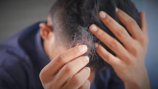 Hair loss and loss of libido have been linked to long COVID
