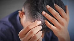 دراسة تربط تساقط الشعر والضعف الجنسي بالأعراض الطويلة لكوفيد 19