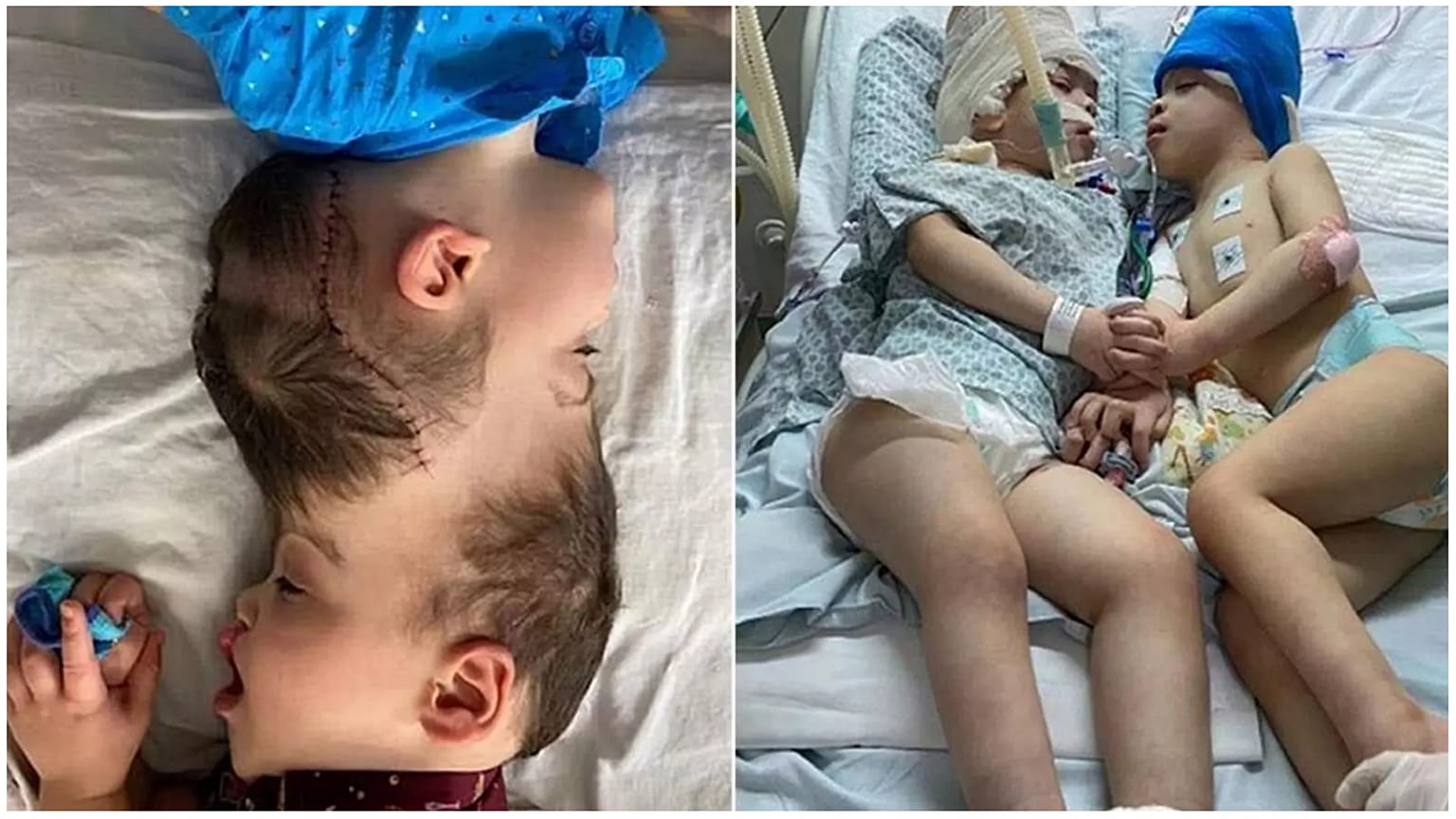 بيرنادو وآرثر بعد فصلهما