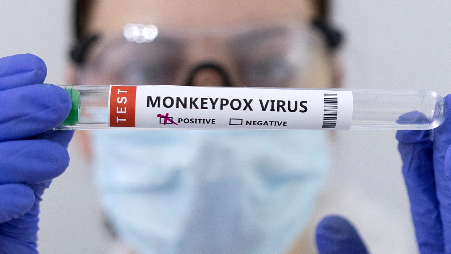 Test tubes labelled "Monkeypox virus positive" are seen in this illustration taken May 23, 2022