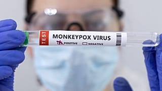 Test tubes labelled "Monkeypox virus positive" are seen in this illustration taken May 23, 2022