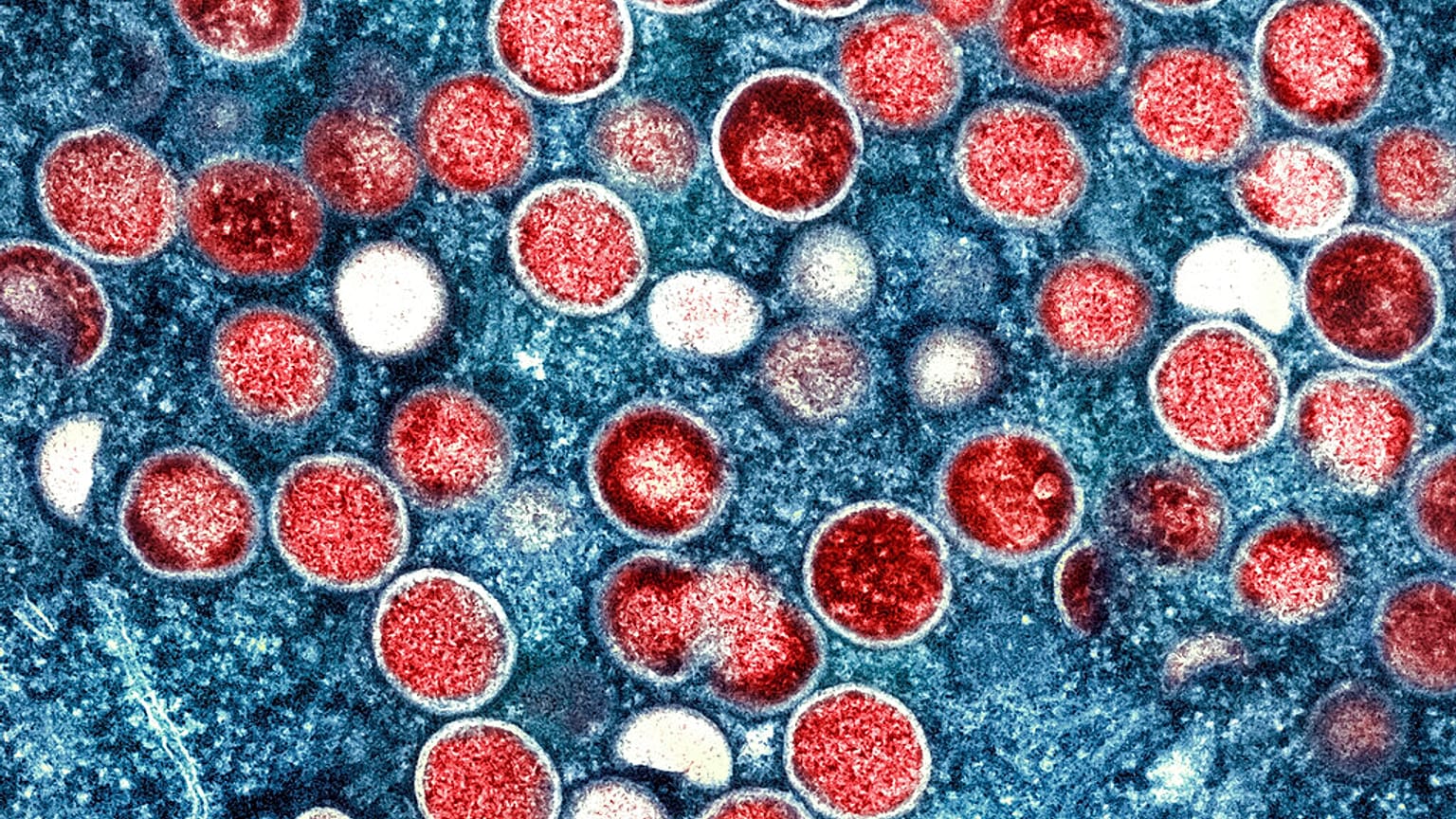 Eine kolorierte Transmissionselektronenmikroskopie von Affenpockenpartikeln, National Institute of Allergy and Infectious Diseases (NIAID).