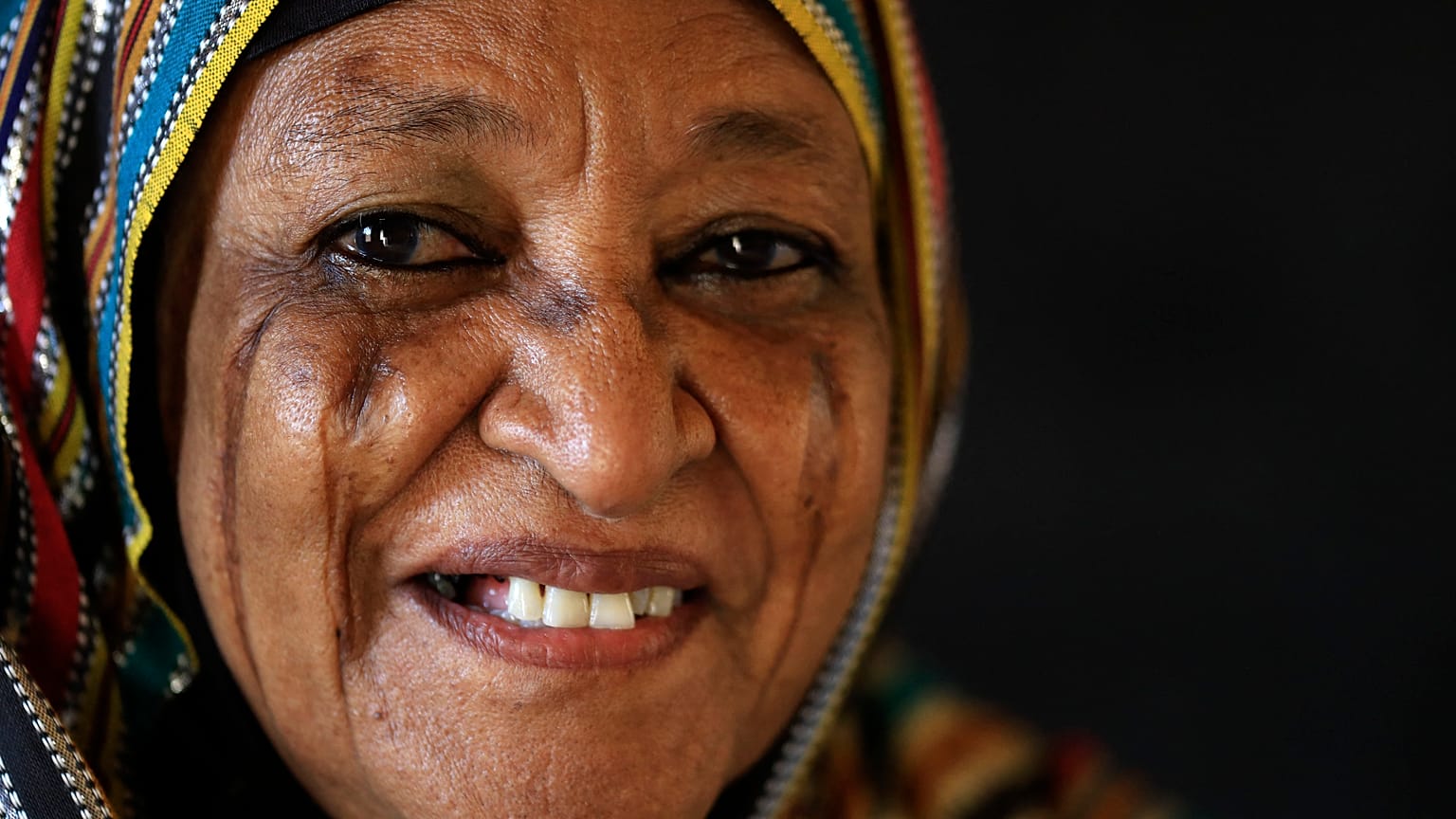 سيدة سودانية تحمل ندوبًا على وجهها في قرية أم مغد بالقرب من الخرطوم في السودان. 