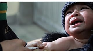 طفل يتلقى لقاح الحصبة في مستشفى أنديرا غاندي للأطفال في كابول، أفغانستان