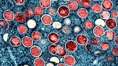 National Institute of Allergy and Infectious Diseases.