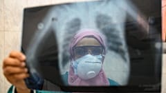 طبيبة مصرية تفحص أشعة سينية لرئة مريض في وحدة الأمراض المعدية بمستشفى إمبابة بالعاصمة القاهرة، مصر، في 19 أبريل 2020
