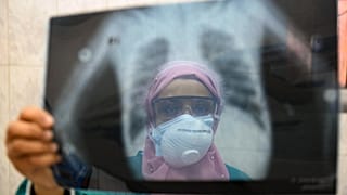 طبيبة مصرية تفحص أشعة سينية لرئة مريض في وحدة الأمراض المعدية بمستشفى إمبابة بالعاصمة القاهرة، مصر، في 19 أبريل 2020
