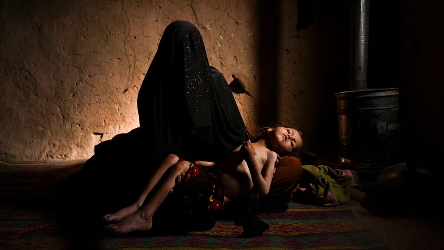 سوءتغذیه کودکان در افغانستان