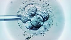 IVF