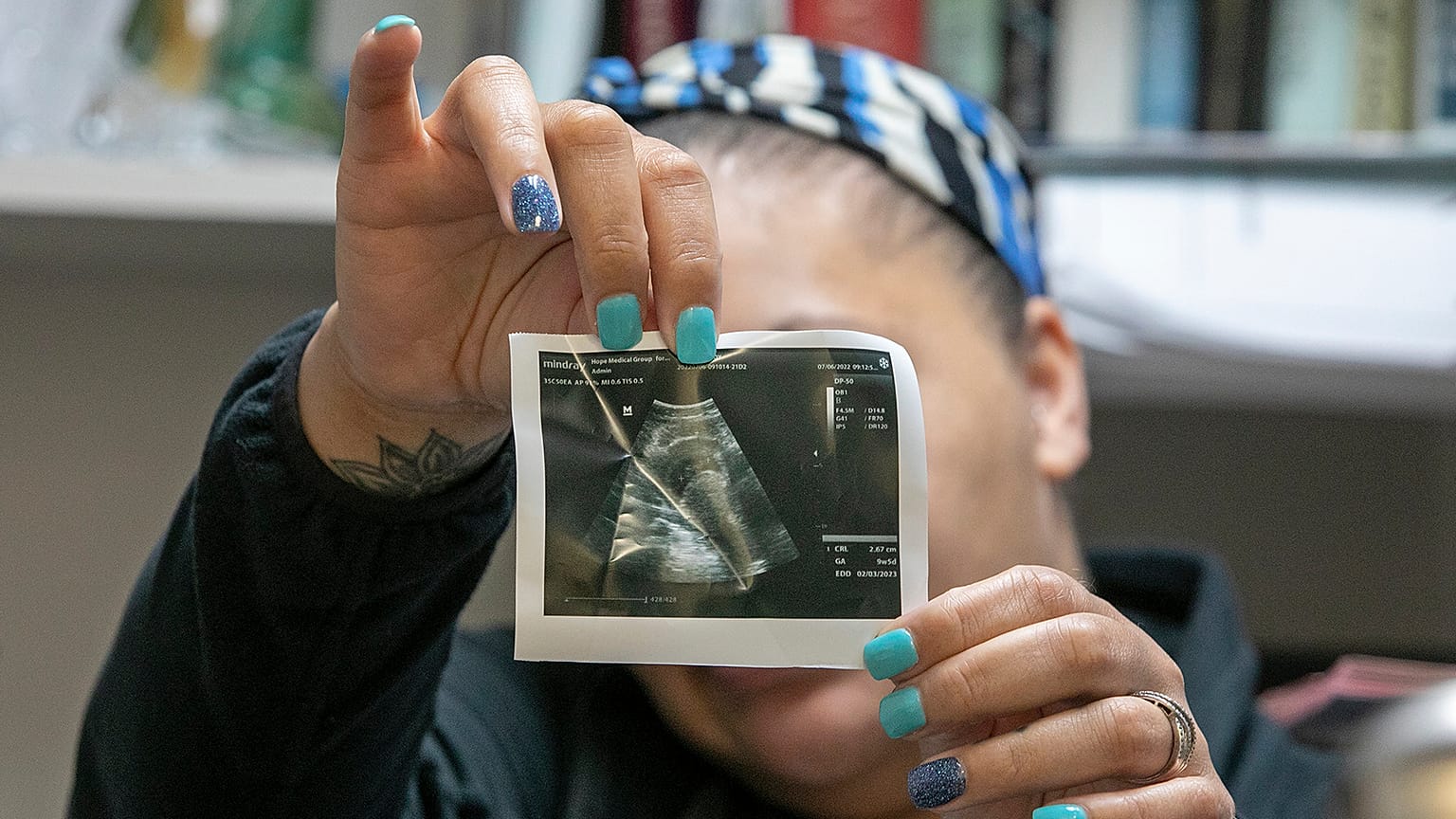 A medical worker shows an ultrasound image of a foetus.