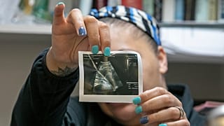 A medical worker shows an ultrasound image of a foetus.