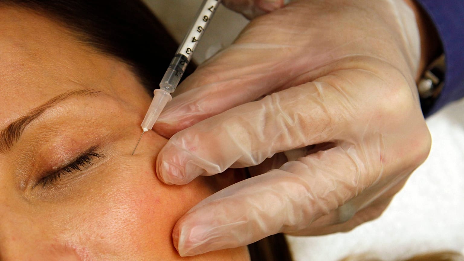 Botox