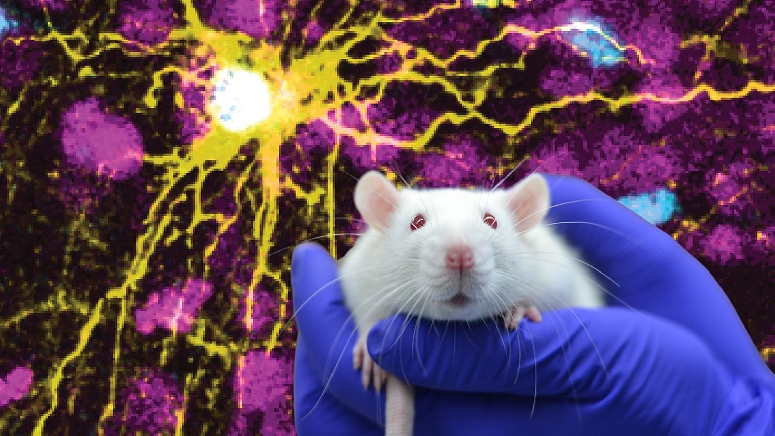 Microscope image provided by Pasca Lab/Stanford Medicine showing a human astrocyte cell (centre in yellow), and human glial cells (scattered in blue) inside a rat brain.