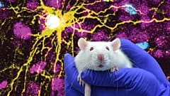 Microscope image provided by Pasca Lab/Stanford Medicine showing a human astrocyte cell (centre in yellow), and human glial cells (scattered in blue) inside a rat brain.