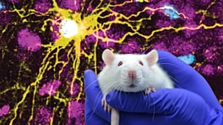 Microscope image provided by Pasca Lab/Stanford Medicine showing a human astrocyte cell (centre in yellow), and human glial cells (scattered in blue) inside a rat brain.