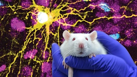 Microscope image provided by Pasca Lab/Stanford Medicine showing a human astrocyte cell (centre in yellow), and human glial cells (scattered in blue) inside a rat brain.