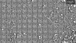 Image au microscope d'une culture de neurones. Selon des neuroscientifiques australiens, ces cellules cérébrales ont démontré un "comportement intelligent et sensible".