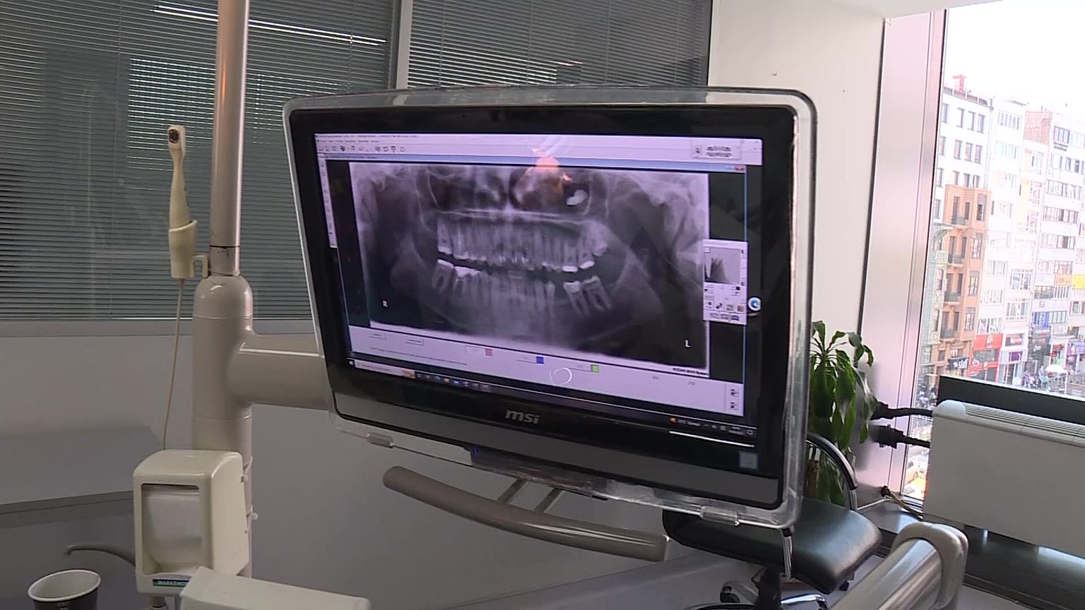 طب الأسنان في تركيا 