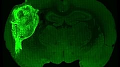 Sıçanların beynine insan beyni benzeri organoid nakledildi