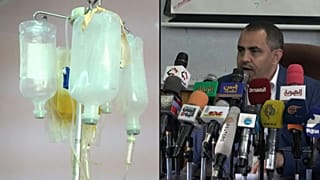 الأدوية الملوثة تحصد أرواح الأطفال في اليمن. 