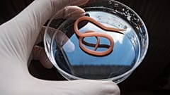 Roundworms share surprising similarities with humans