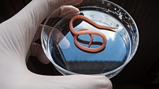 Roundworms share surprising similarities with humans