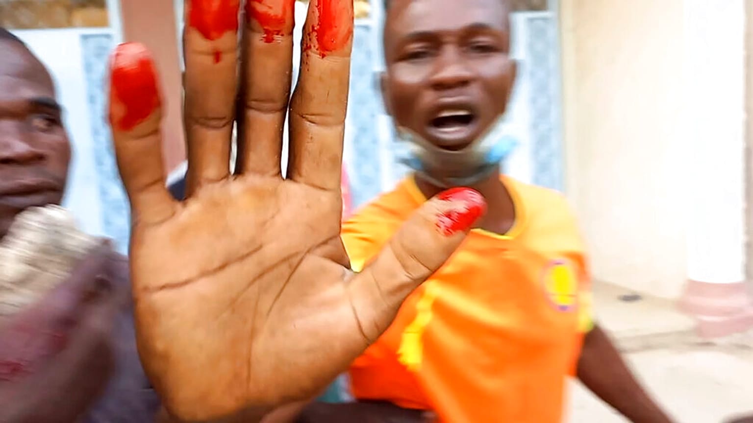 Un manifestant avec la main ensanglantée, à N'Djamena, Tchad, le 20 octobre 2022