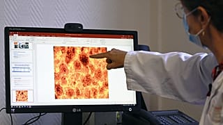 لورانس كيسل ، أستاذة أمراض السكر في مستشفى جامعة ستراسبورغ، تشير إلى صورة مجهرية على الشاشة لجزر البنكرياس. 2022/11/14