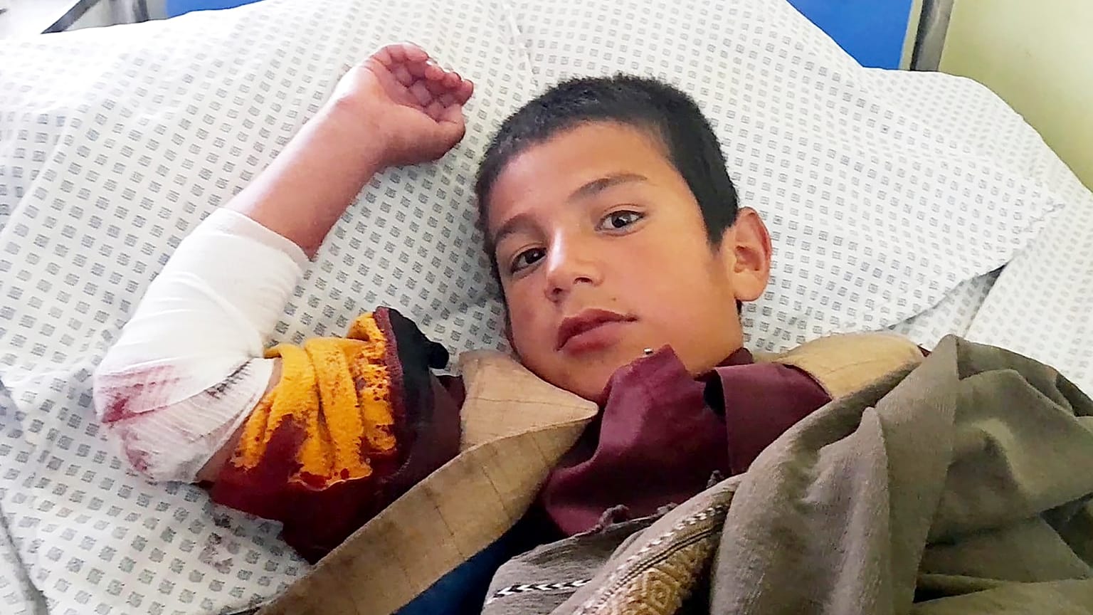 A wounded boy receives treatment at a hospital after the deadly bomb blast.