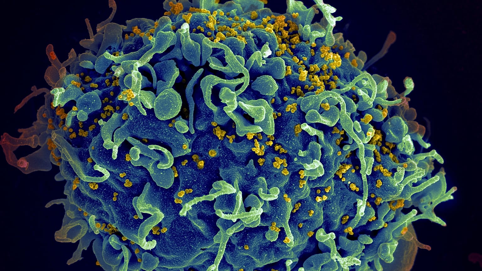 Mavi kısımlar insan hücresi, sarı noktalar HIV virüsü