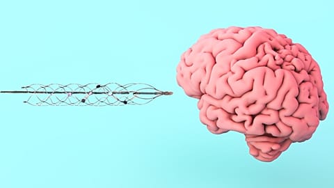 Elon Musk’s Neuralink is betting on brain-computer interfaces, but this company is one step ahead