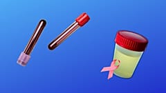 A simple blood or urine test can detect 14 types of cancer before they spread