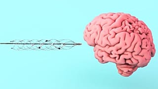Neuralink Илона Маска работает над интерфейсом мозг-компьютер. Компания уже на шаг впереди конкурентов