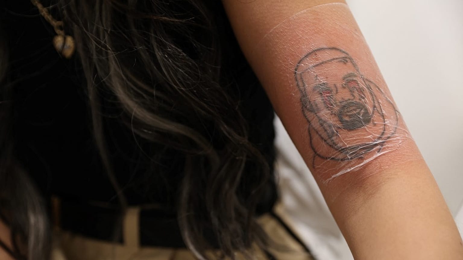 Kimberly Westgarth lässt sich ihr Kanye West Tattoo kostenlos entfernen