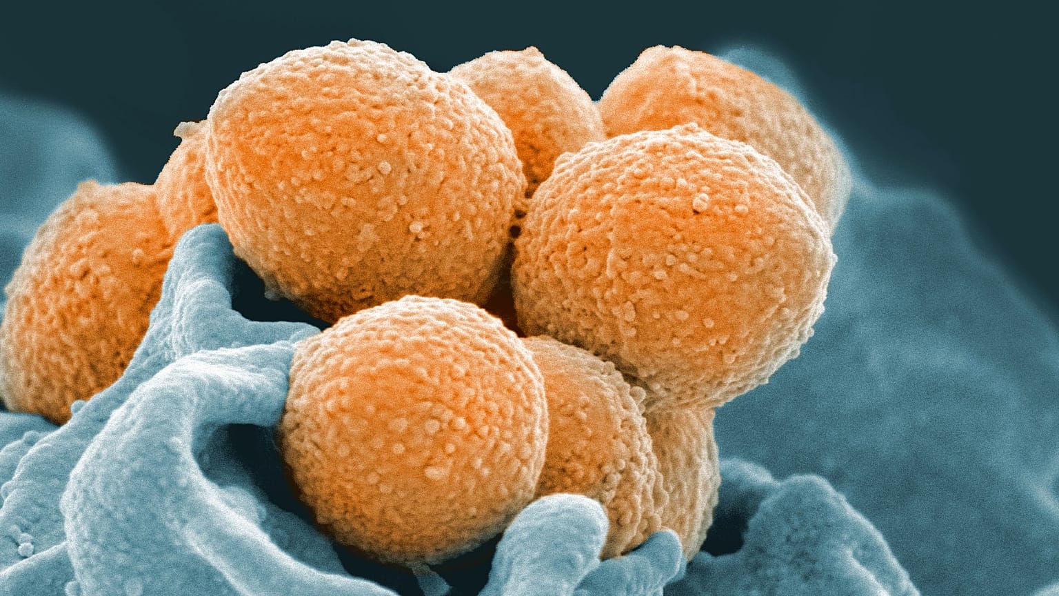 An electron microscope image of Group A Streptococcus (orange) during phagocytic interaction with a human neutrophil (blue). 