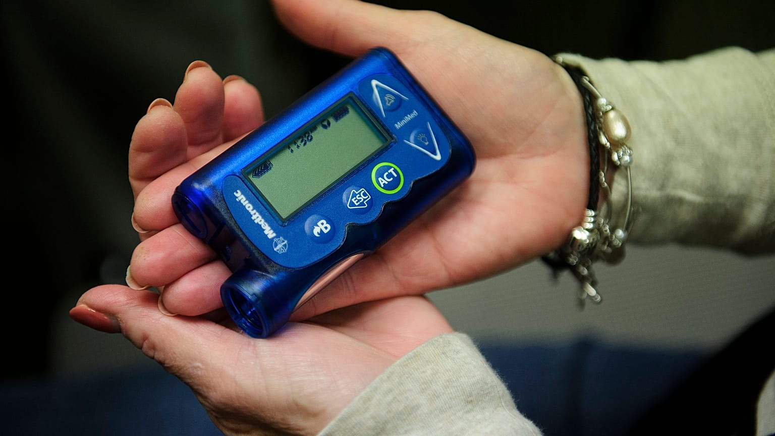 A new artificial pancreas technology free patients from finger prickers and insulin shots.