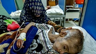 صورة أرشيفية لأم أفغانية تساعد طفلها المصاب بسوء التغذية الحاد والذي يتلقى علاجاً في مستشفى أنديرا غاندي في كابول، أفغانستان، 22 مايو 2022.
