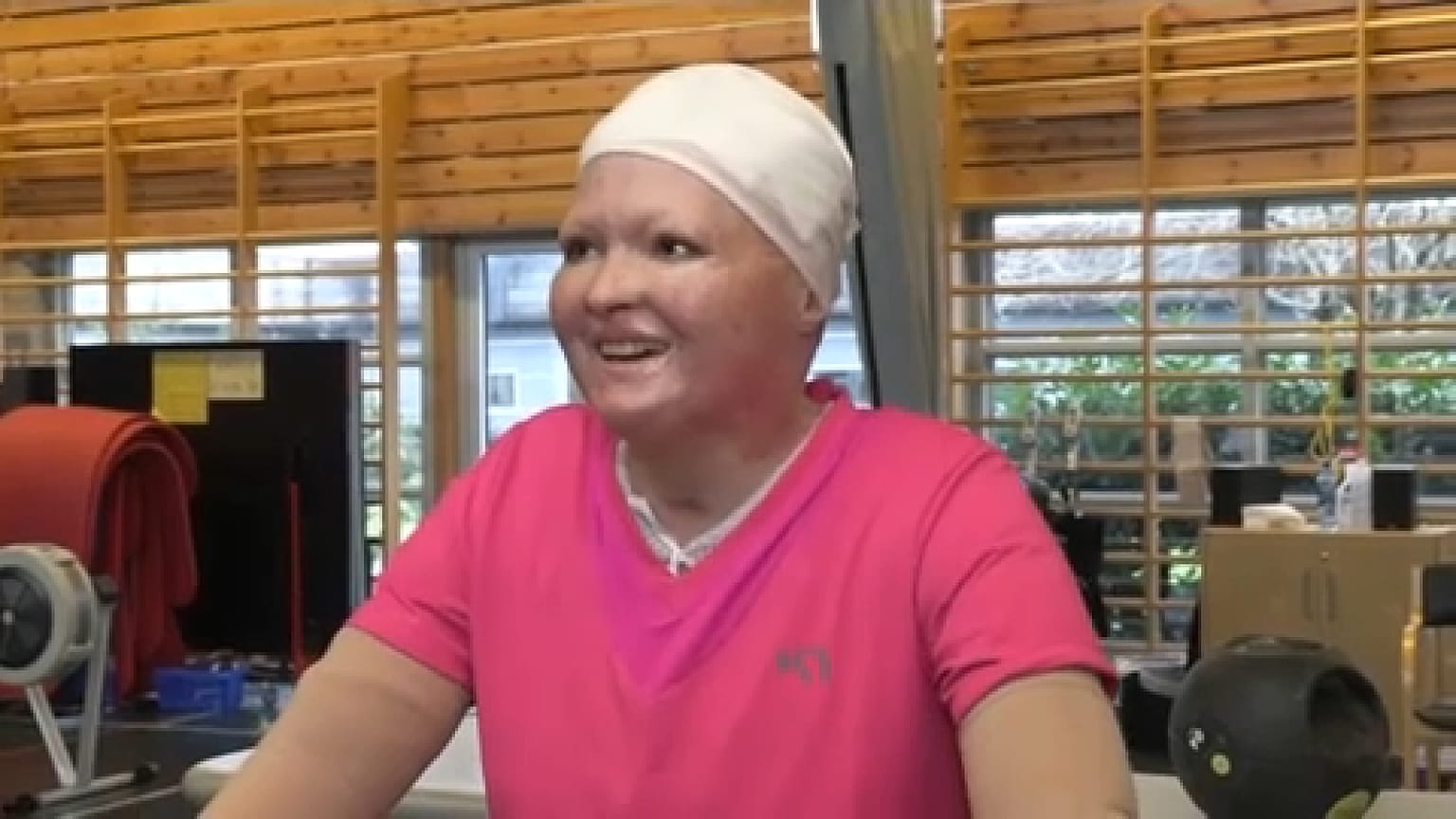 عانت كينجا من حروق من الدرجة الثالثة طالت 85٪ من جسدها، لكن الأطباء في مستشفى جامعة هاوكلاند، في جناح الحروق، تمكنوا من معالجتها.