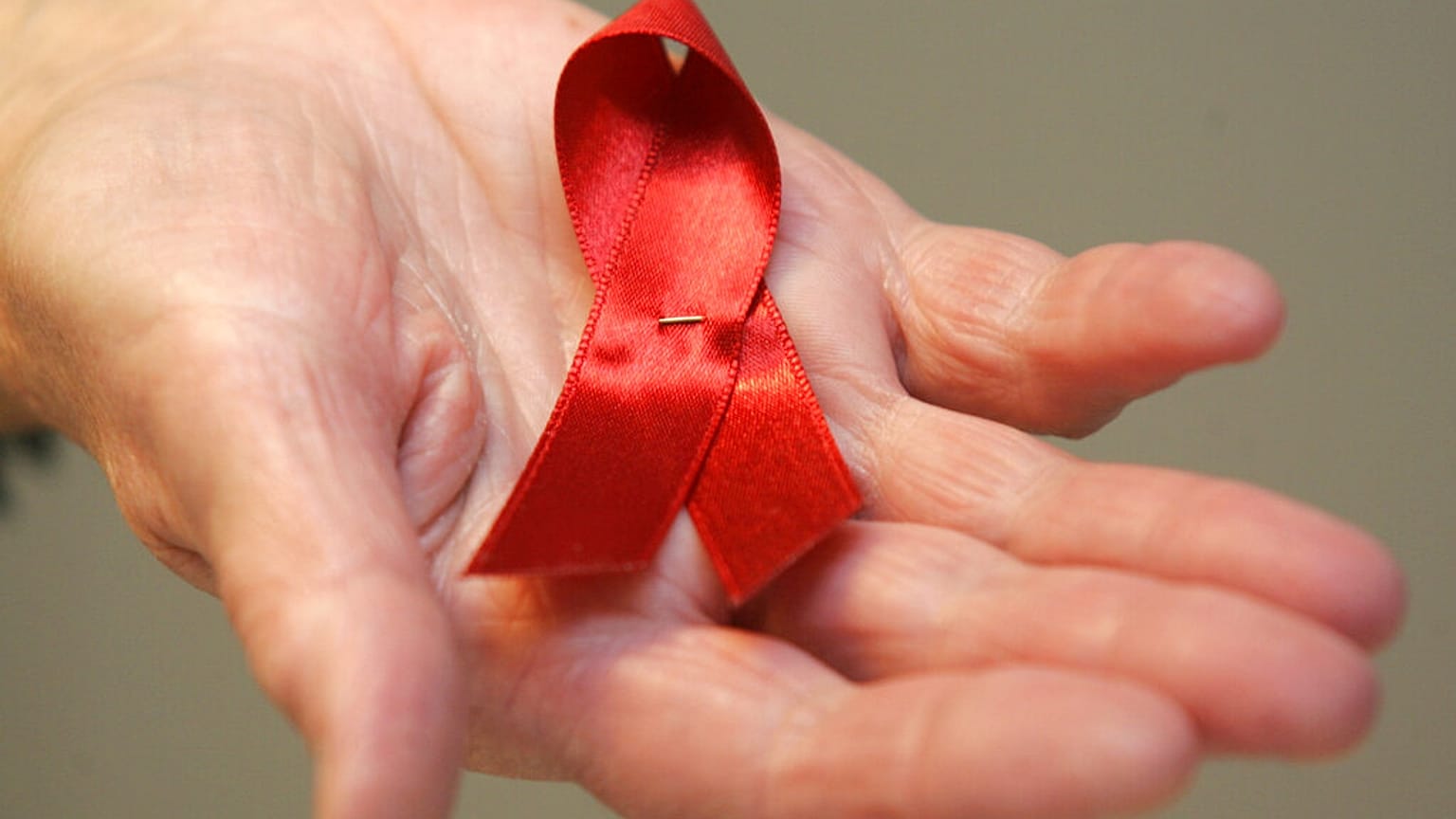 Lösemi tedavisi için yapılan kök hücre nakli üçüncü hastayı da AIDS'ten kurtardı